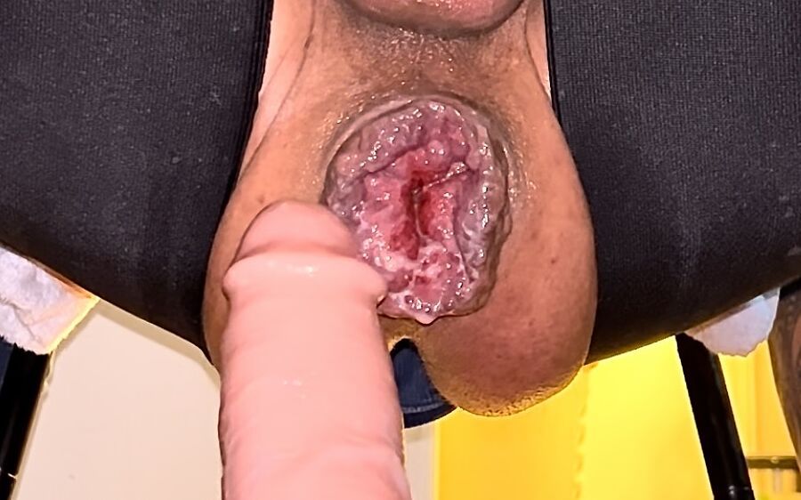 Extreme anal masturbation