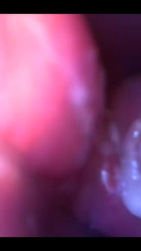 Who Want See What Is Inside Me?? Inside My Pussy??:) Look This Video