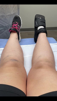 Welp, I messed up my foot