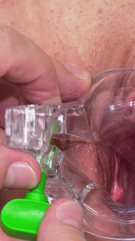 Big Clit Pussy Examined with Speculum