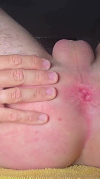 Amateur Anal Stretch