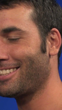 Rugburn