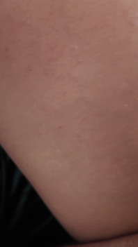 หมัดใหญ่ยืดขนของนักเรียน