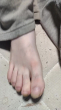 Unleashing the Beauty of My Naked Feet for You