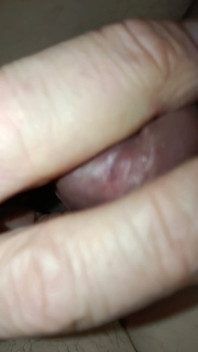 Is My Meatus Open?