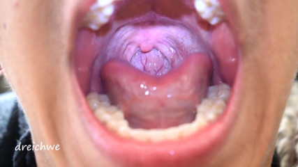 Dreichwe: Uvula fetish mouth
