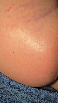 Brazilian Wax Asshole