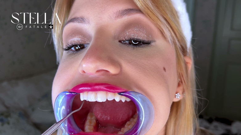 Stellafatale: Mouth Retractor Teeth Examination