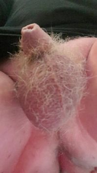 M Tinydick