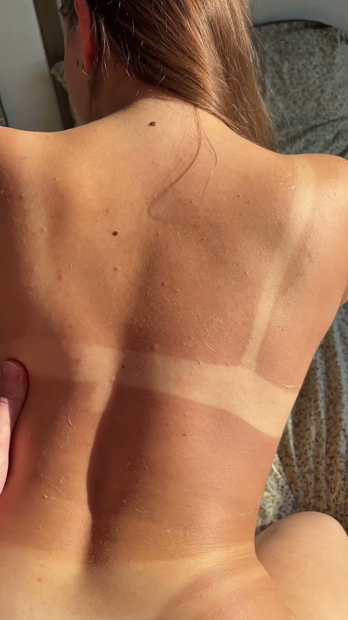 MY_PRIVATE_iCLOUD: Winzige brünette stiefschwester bekommt super sonnenbrand - ich reibte lotion auf...