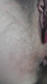 Prolapse Play Close up