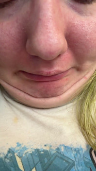 Chin Faces
