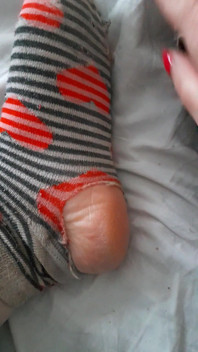 Old Tearing and Dirty Socks