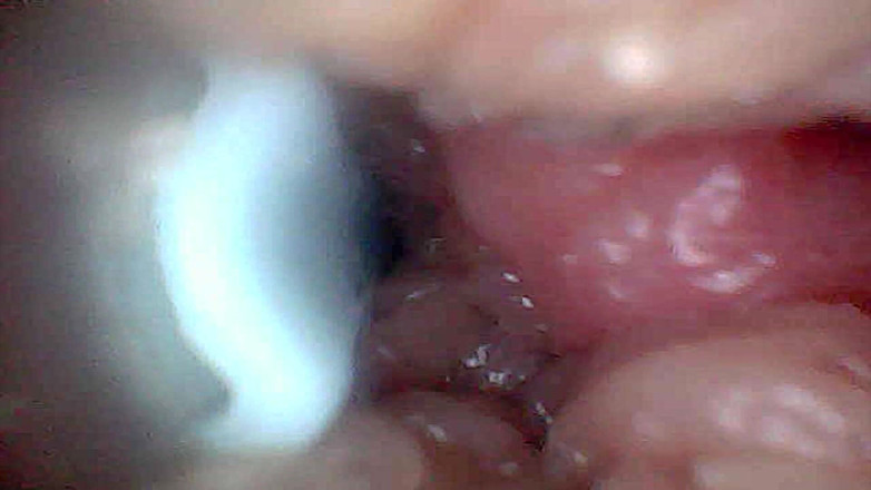 Ladybottox: Panduan Visual Untuk Stimulasi G-Spot Dan Orgasme Endoscop Perspektif