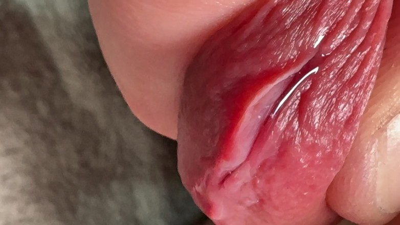 Leonardo-1974: Dita nel pene. Foro nella penetrazione del pene.