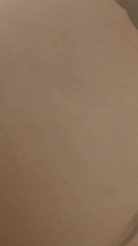 4568866