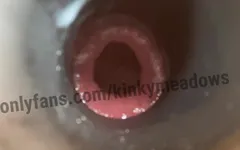 空心肛塞训练