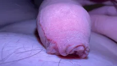Sikimin üzerinde makro teni
