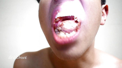 Dreichwe: 食べるエピソード7