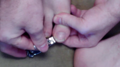 Au79: Klippning av mina fula tånaglar