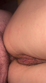 Anal Dureros