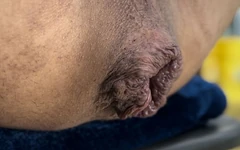 Un énorme trou du cul