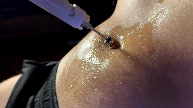 Navel fans: Bellybutton Mekanik