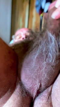 Hairy Balls