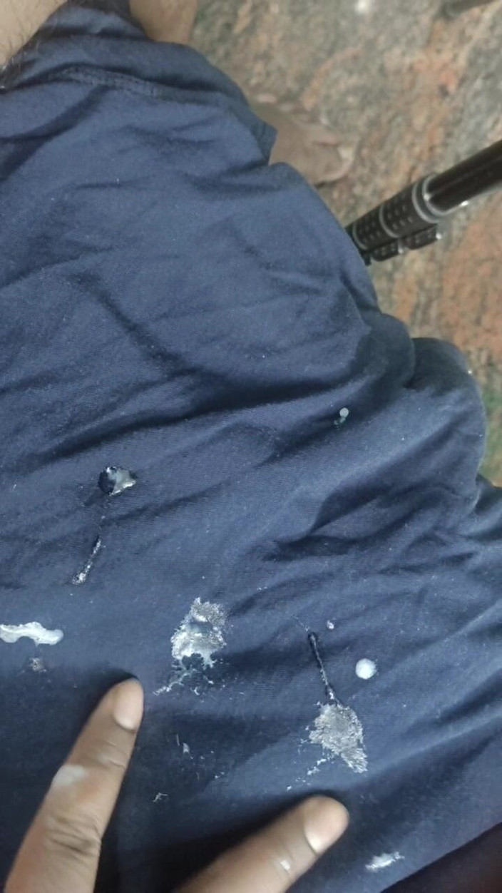 Fapidontmind: 射液在黑色的底衣上