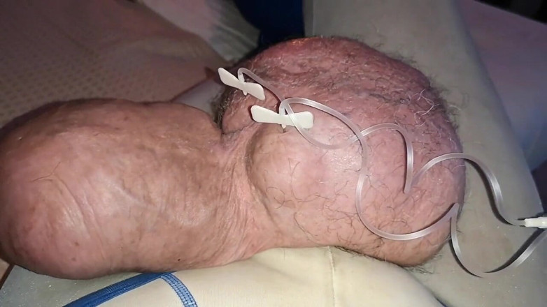 Monster_Meat_: 2liters glukozunun çifte dolgusu