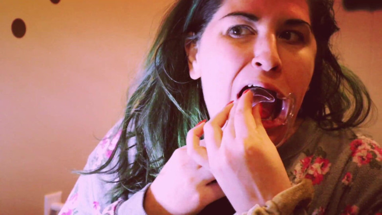 goddessjoules: Préparation des aligners invisibles