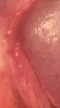 Daddy with Lumpy Glans Feels Huge Orgasm.