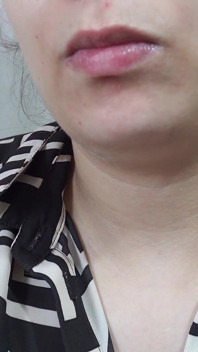 Si Dia Bermain Dengan Hidung Saya. Saya meletakkan pad silikon merah jambu nipis dalam hidung saya dan bermain dengannya. Saya tidak tahu apa itu,