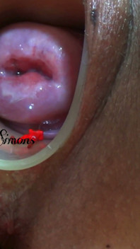This Is What My Cervix Looks Like After a Year Without Seeing It.