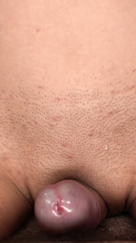 Beca reçoit un facial sournois
