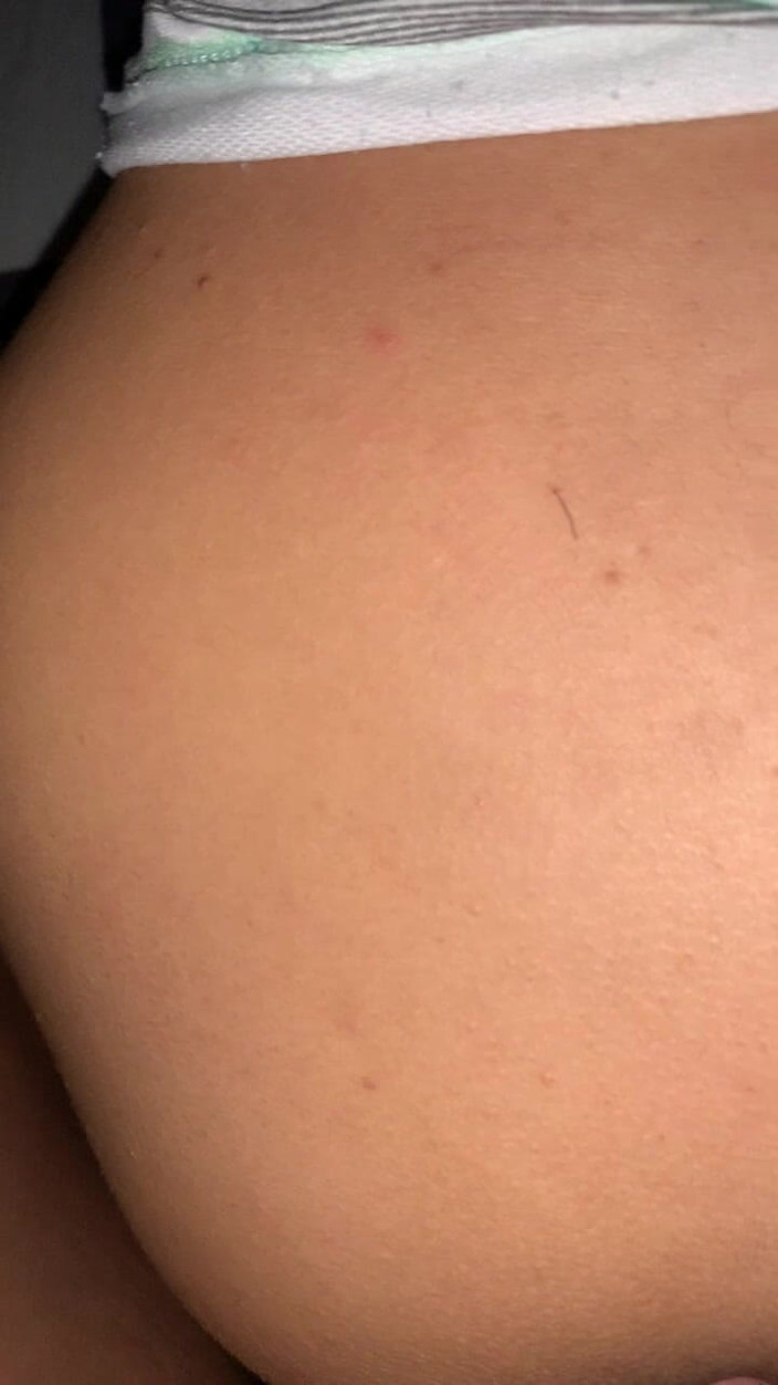 Indo Girl: Weer anaal proberen croot gaat nog steeds door