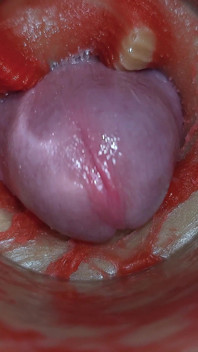 Cámara Dentro Del Coño Profundo Captura Eyaculación Muy Grande De Esperma Asmr