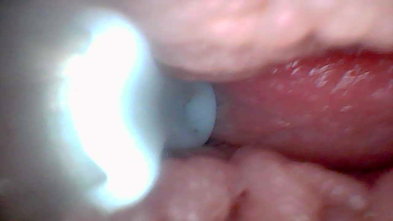 Twittiy: Mari Kita Mengintip Pepek Berair Saya Bersama-sama (Kamera endoscope)