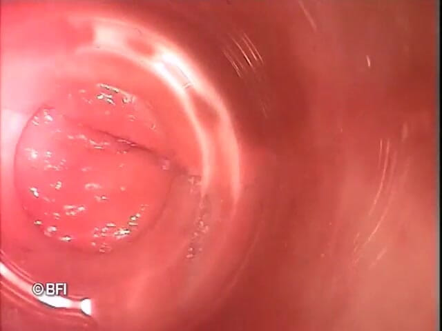 Pegging insertion: File bizzarri 163