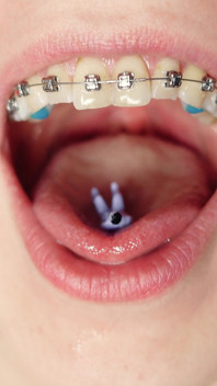 Giantess Devour Fetish in Braces