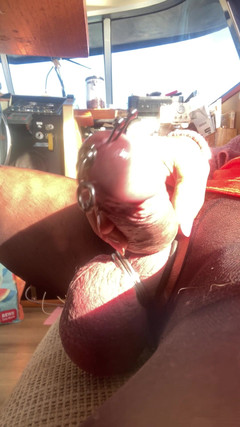 Sonitchka: より濃い卵