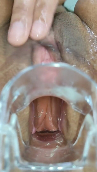 Xamy_97: Expansión anal con espéculo
