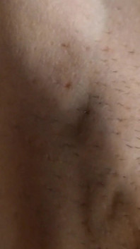 Abs Veins
