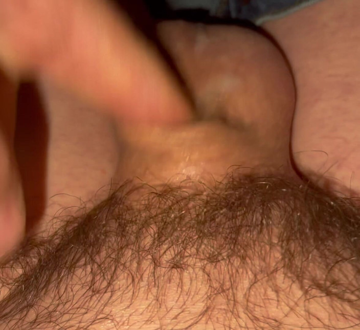 Timmdaddy2000: My Tiny Cock Before the Blue Pill