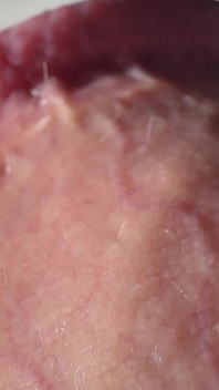 Penis Tropft