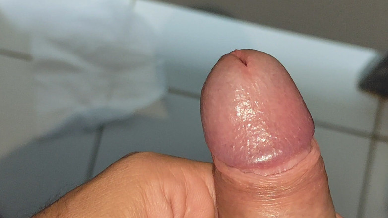 Straight Daddy Club: Large Deformed Cock with Lumpy Glans.