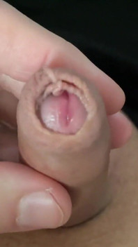 Small Forskin Penis