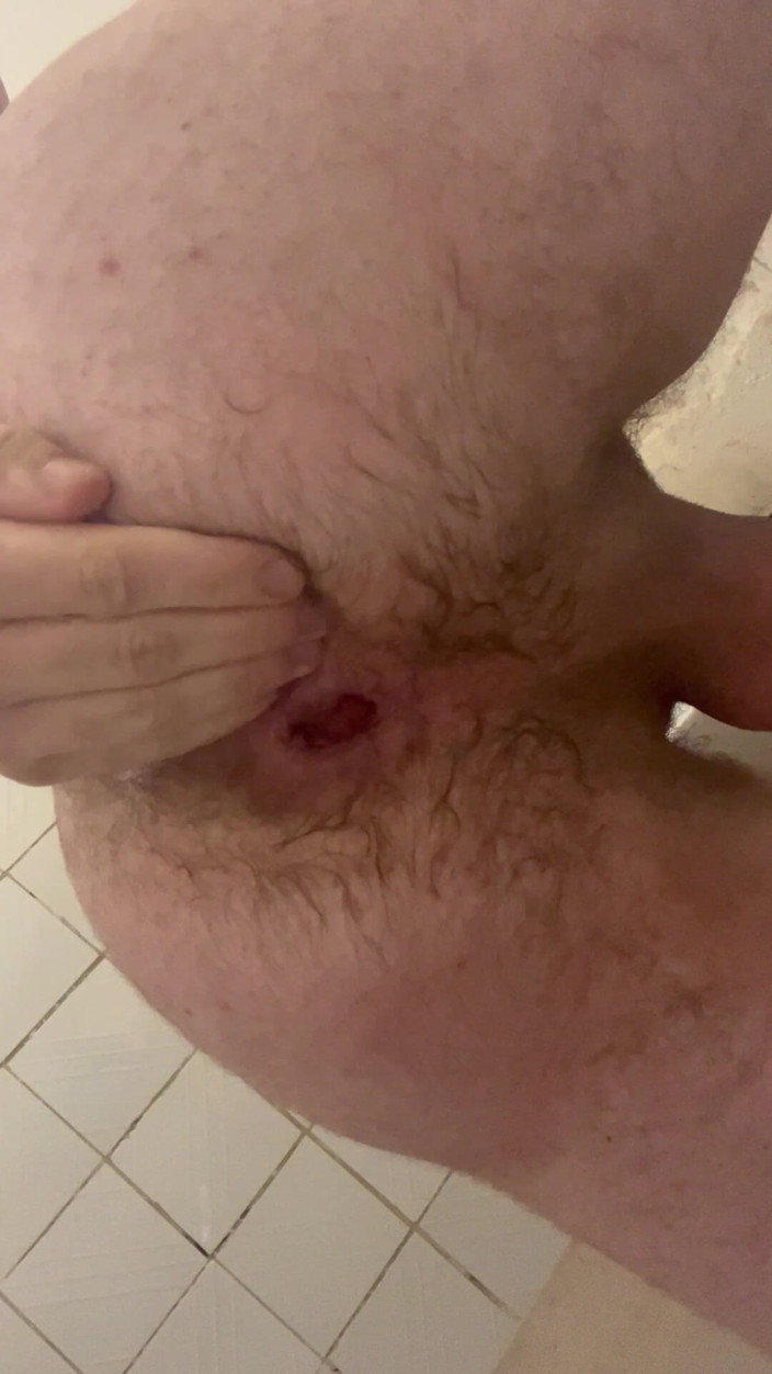 Calciferol333: I Like to Fuck Myself and Work Fisting