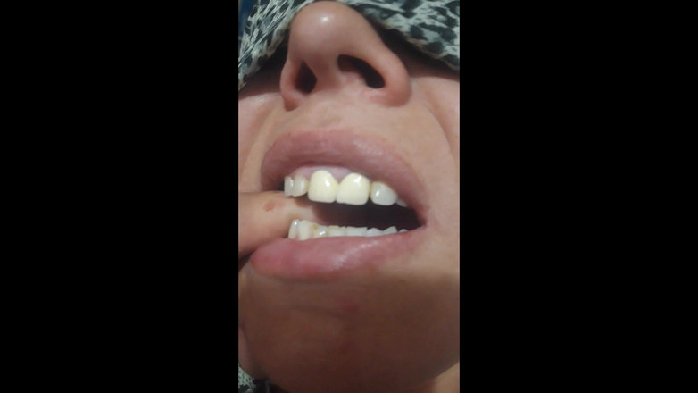 Paultramp: Ugryzienie palcem