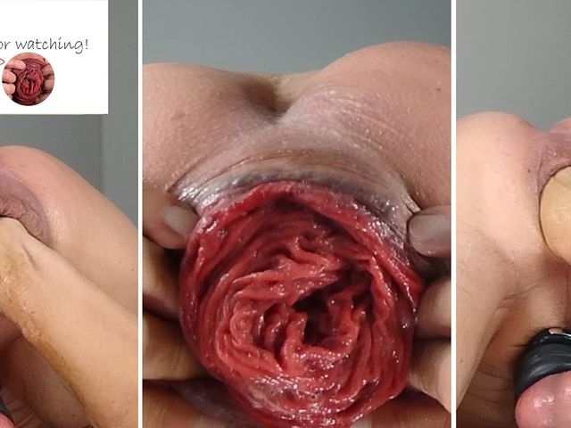 Popoopoop. Selffist - Fisting My Ass - My New Passion - Rough Anal Self Fisting - Prolapse and Rosebud (Dildo Prolapse Show)